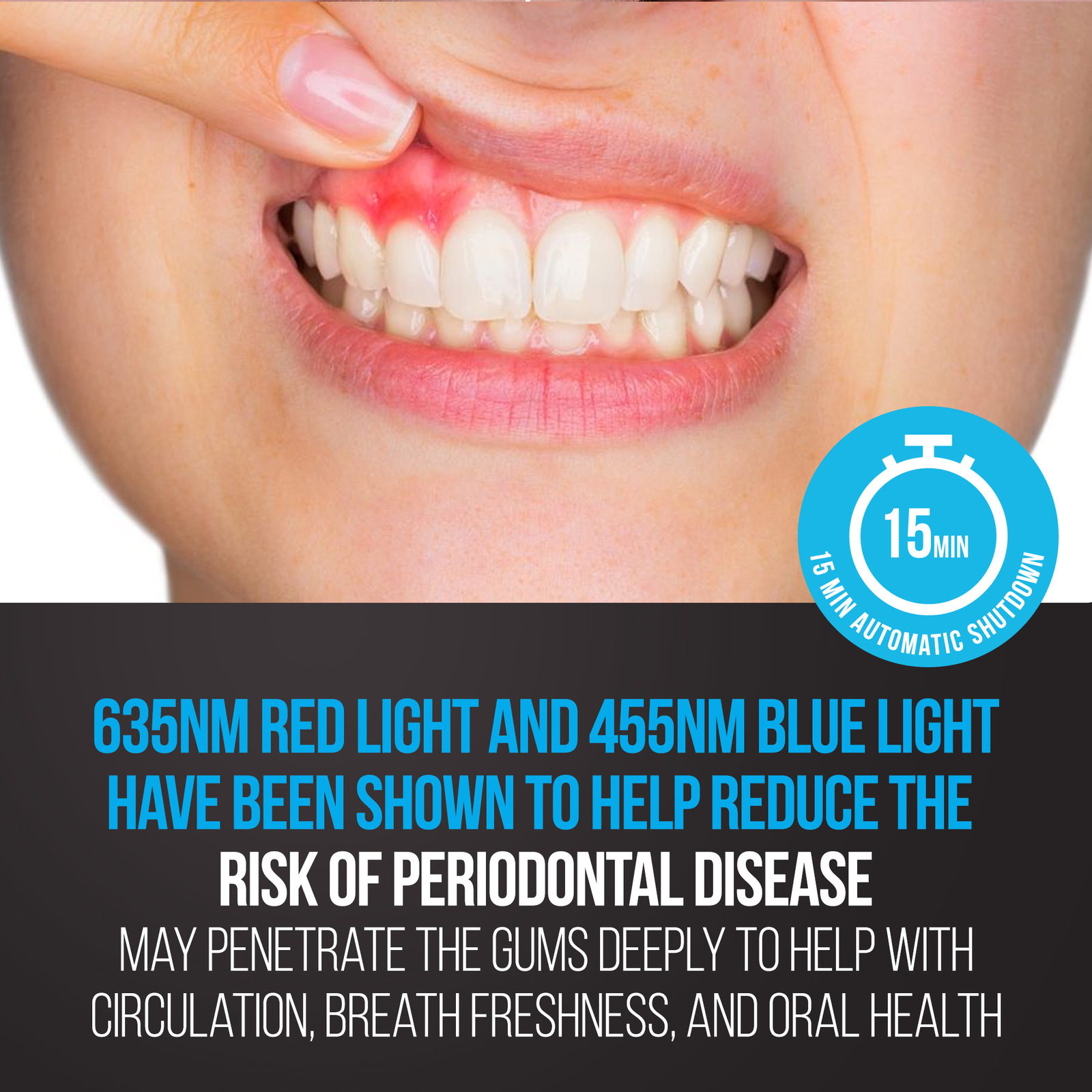 Starlite Smile Blue and Red Light Therapy Gum Disease Light
