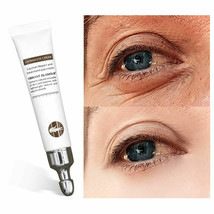Magic Cayman Eye Cream for Dark Circles, Puffiness, &amp; Wrinkles - $14.84