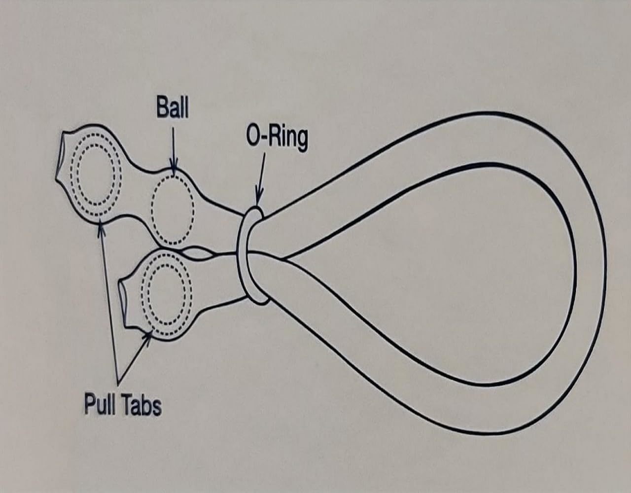 Timm Medical VenoSeal Venous Leak Constriction Loop VenoSeal