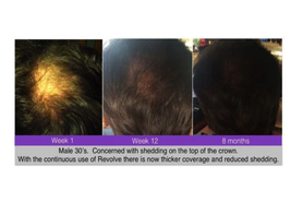 ZENAGEN Men’s Treatment to Restore & Replenish Hair, 6 fl oz image 3