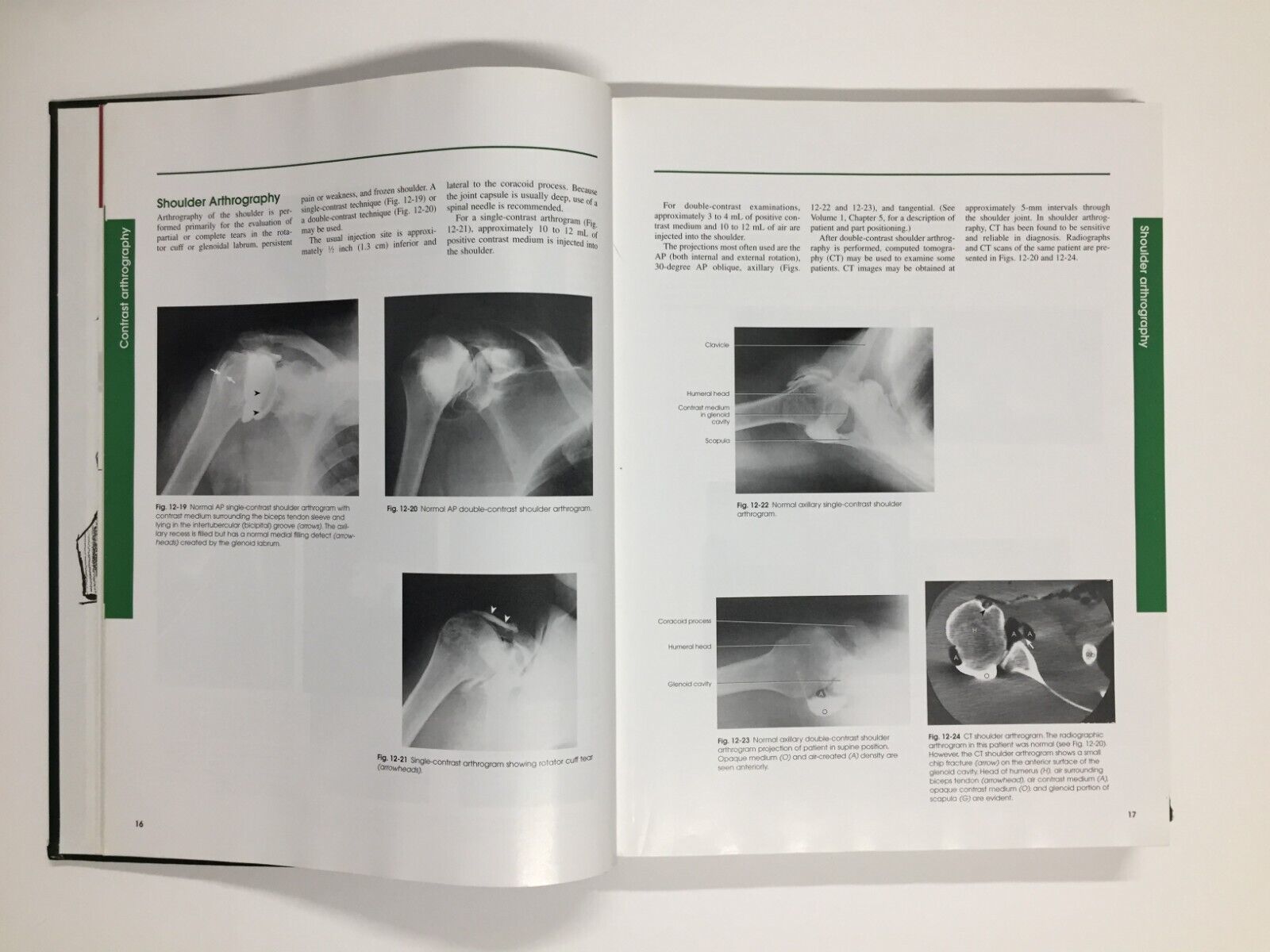 Radiographic Positioning and Procedures by Bruce W. Long, Eugene D