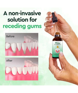 30ml Gingival Repair Drops Teeth Whitening Women Men Mouth Periodontal G... - $9.99