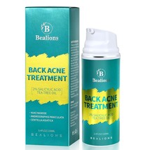 Back Acne Treatment, Butt Acne Clearing Cystic Acne Treatment 2% Salicyl... - $17.81