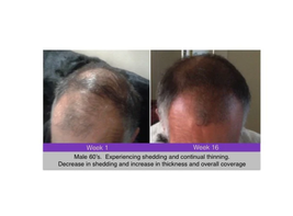 ZENAGEN Men’s Treatment to Restore & Replenish Hair, 32 fl oz image 2