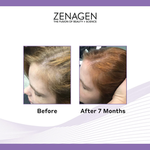 ZENAGEN Women’s Treatment to Restore & Replenish Hair image 6
