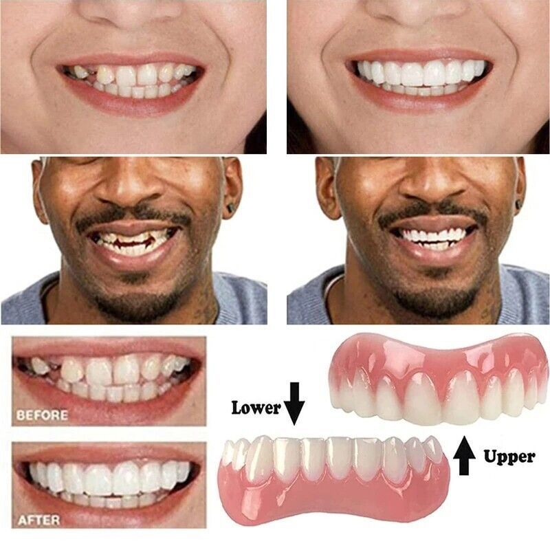 Veneers False teeth snap on instant Smile veneers Cosmetic Teeth