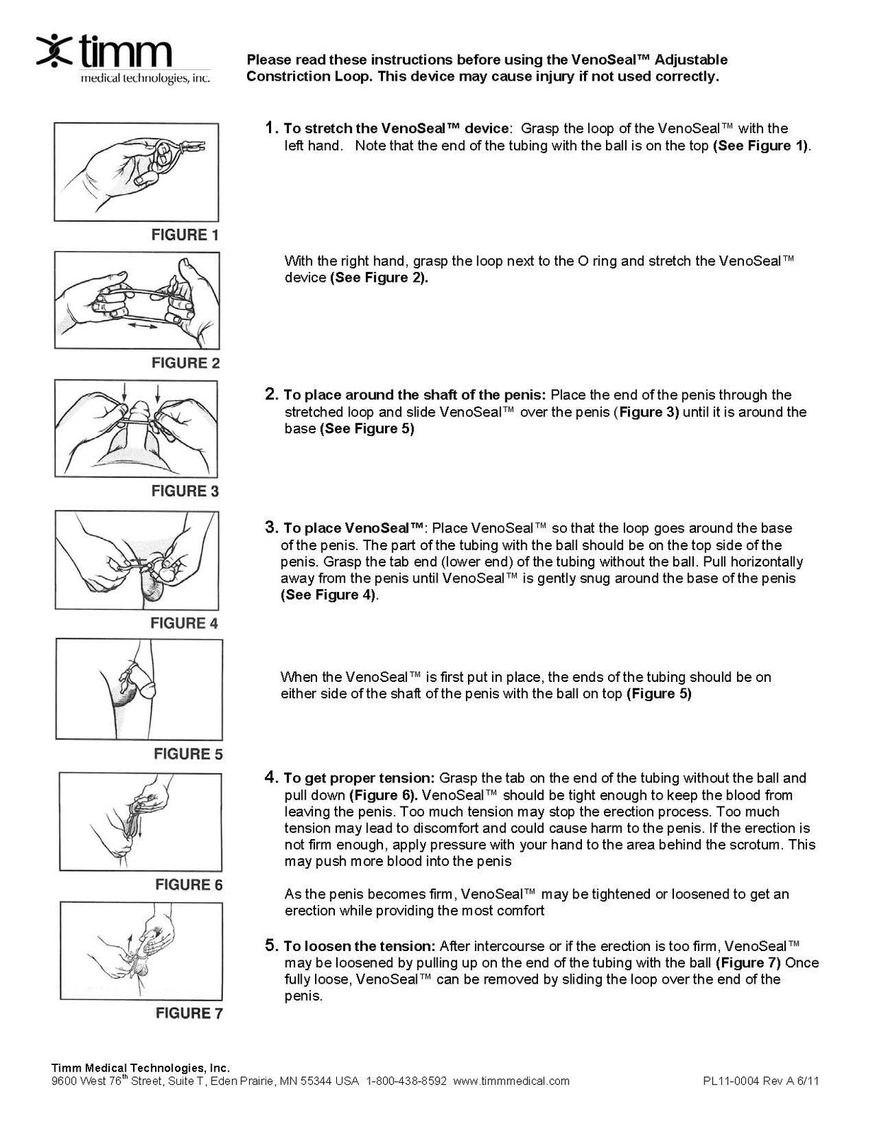 Timm Medical VenoSeal Venous Leak Constriction Loop VenoSeal